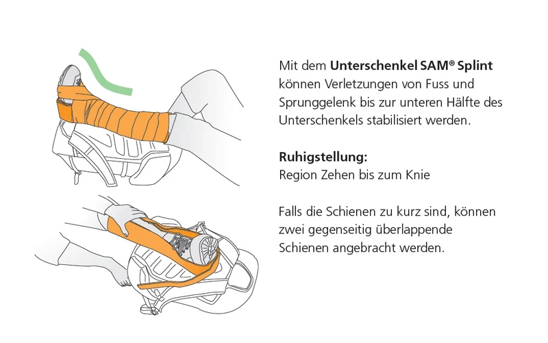 Universalschiene Sam Splint